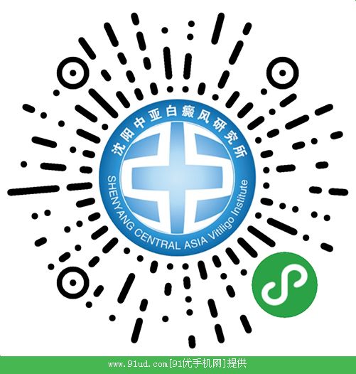 辽宁沈阳中亚白癜风专科二维码